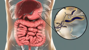 Helicobacter pylori Test for Stomach Health: Detect Gastritis Causes Early, Explore H. pylori Diagnosis, and Uncover Hidden Dangers